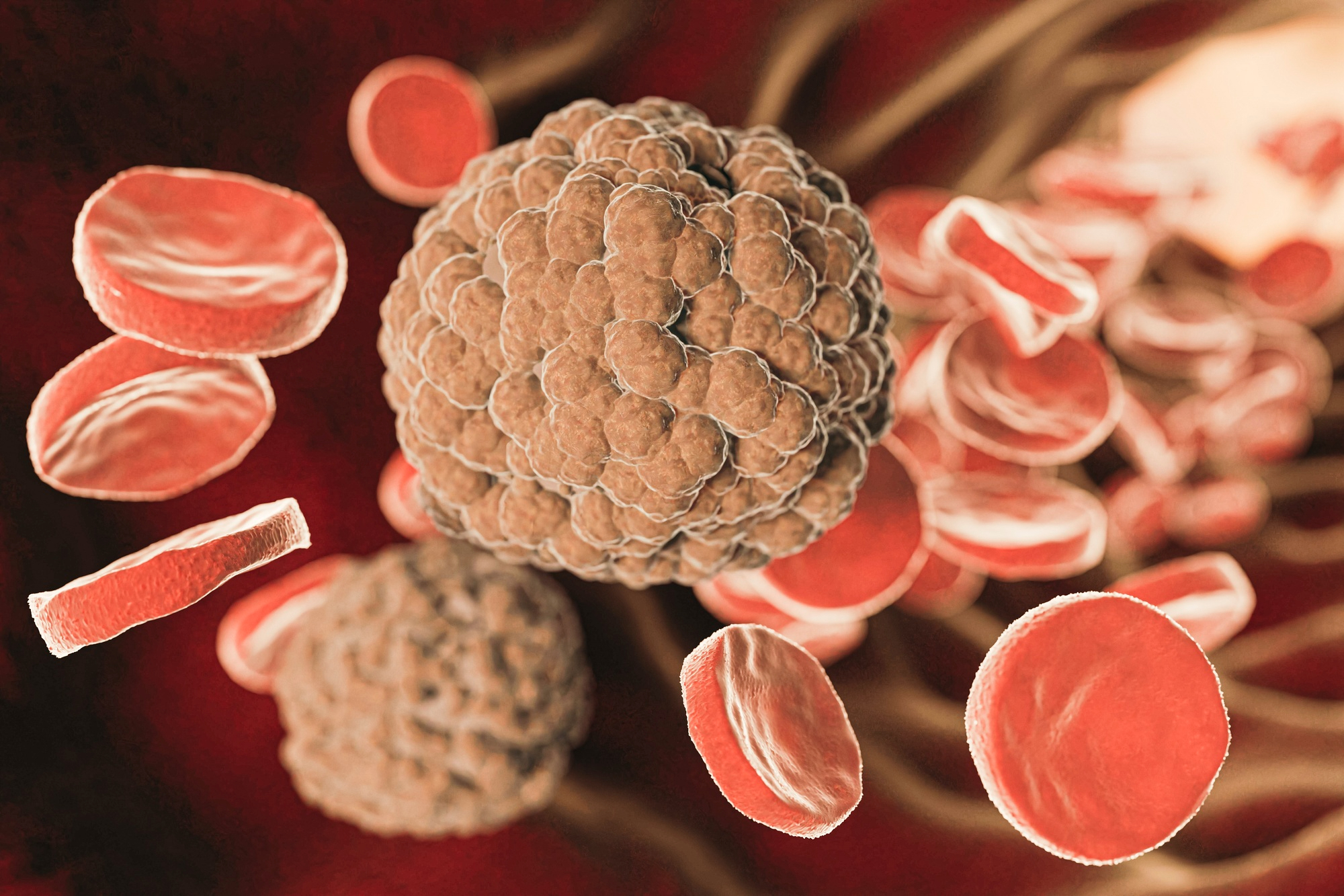 Веб інфекція лікування