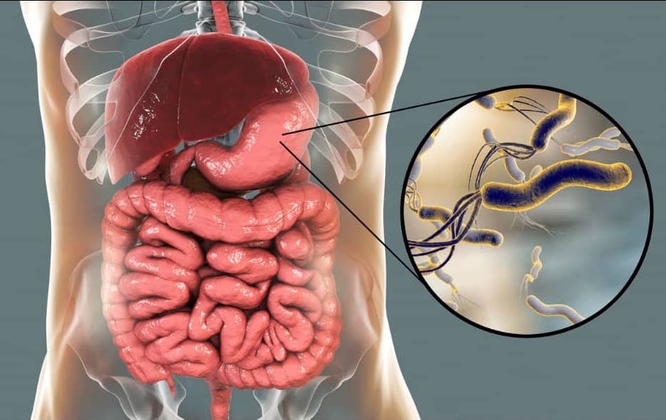 Хелікобактер лікування