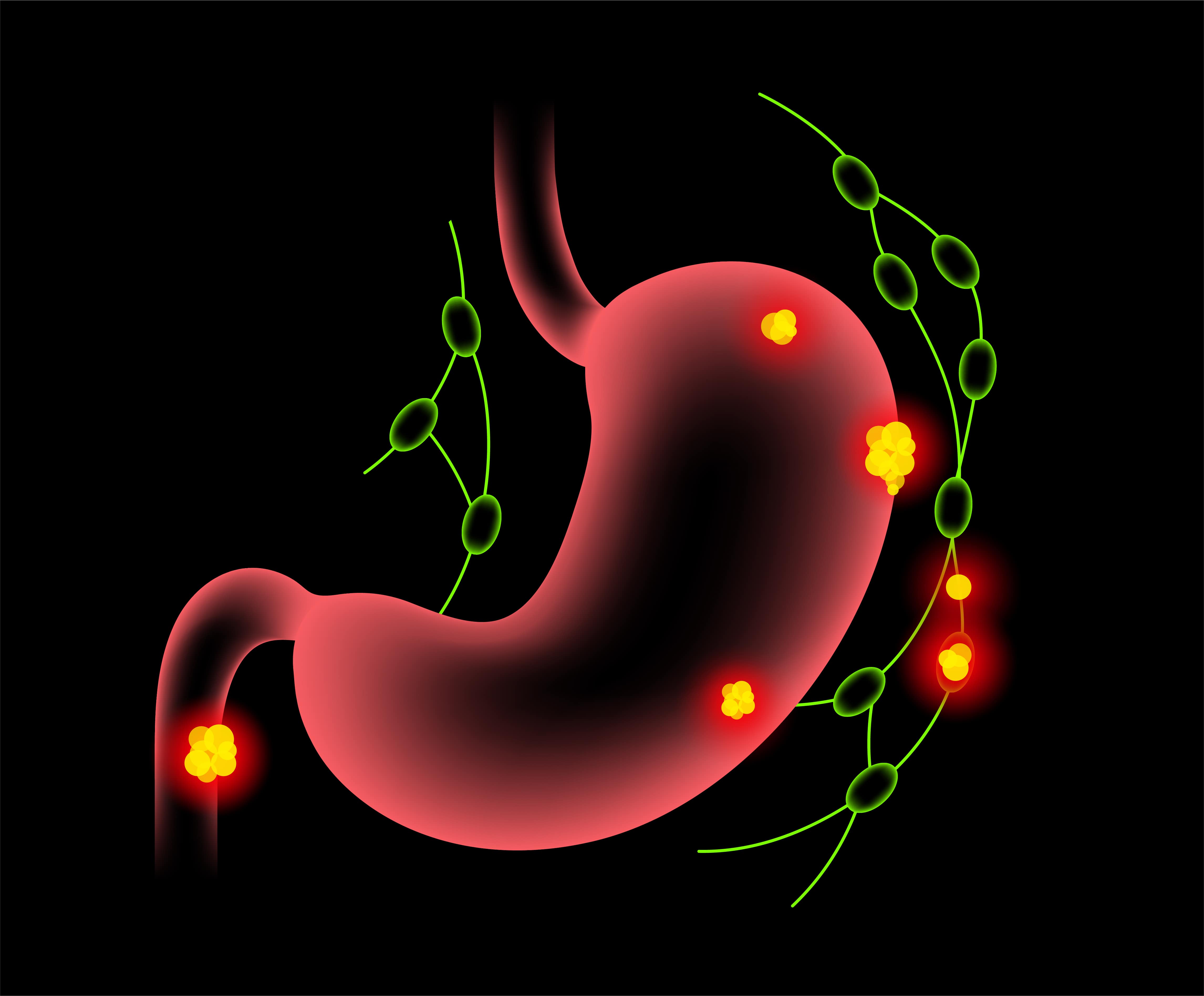 Хелікобактер пілорі лікування