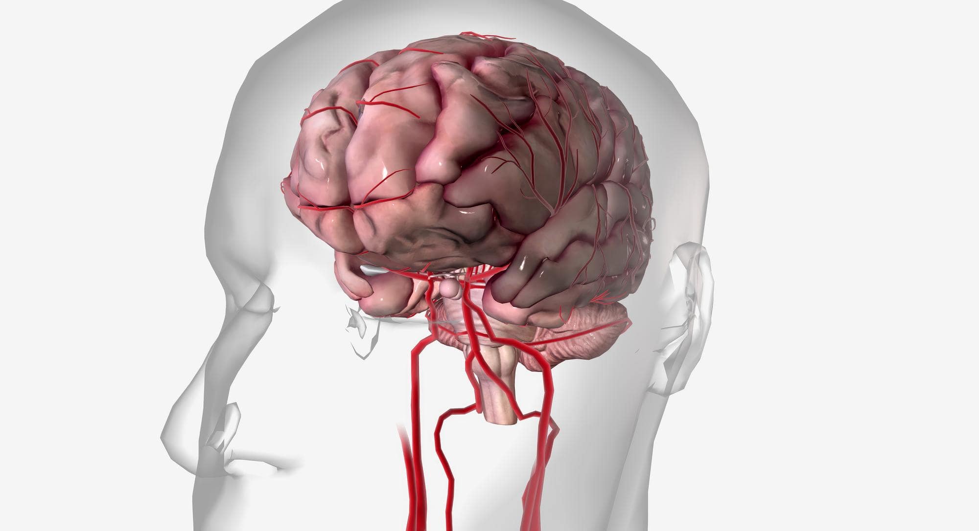 Лікування церебрального атеросклерозу
