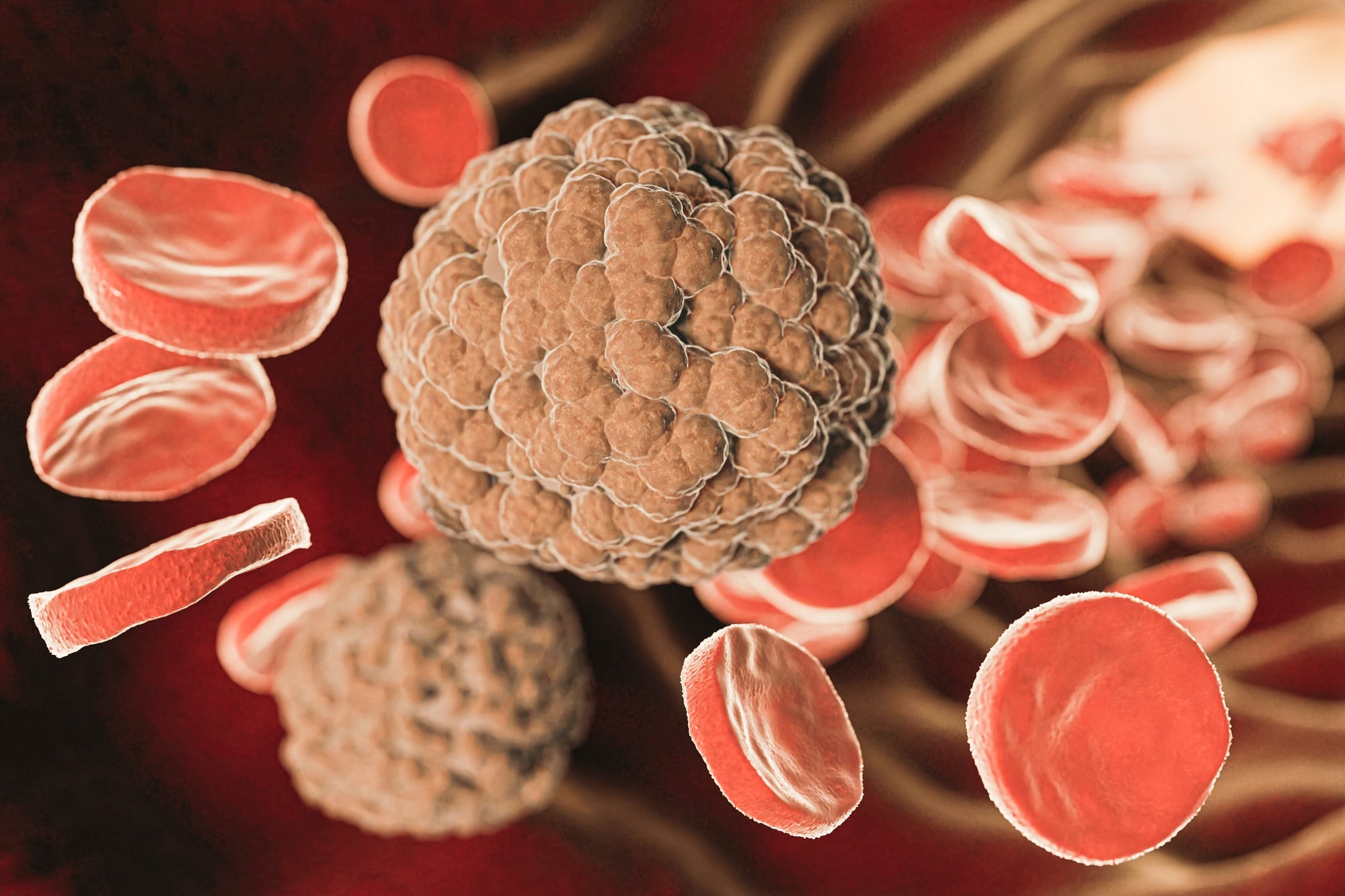 Стрептококк вириданс лечение